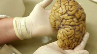 New Atlas of Prefrontal Cortex Gene Activity Offers Path to Targeted Brain Disorder Treatments