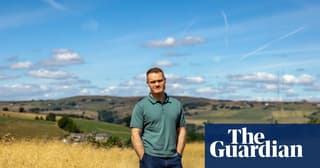 Patient recounts 16-hour brain surgery where surgeons accidentally dropped his skull