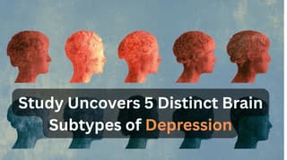MEG Scans Reveal Five Distinct Brain Profiles for Depression, Challenging Uniform Diagnosis