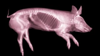 Shinbone Compression Triggers Brain Repair via Blood-Borne Signals
