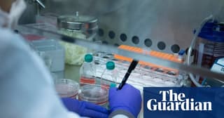 US Sickle Cell Patients Face Severe Access Gap for Red Blood Cell Exchange Therapy