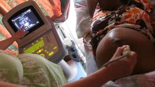 Global HIV Prevention Collapse: US Aid Cuts Trigger Service Gaps and Deaths