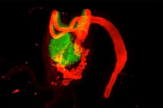 Rediscovery of the Rete Ovarii Challenges Century-Old Medical Assumptions