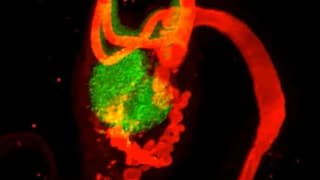 Revisiting the Rete Ovarii: New Research Challenges Its Status as Vestigial