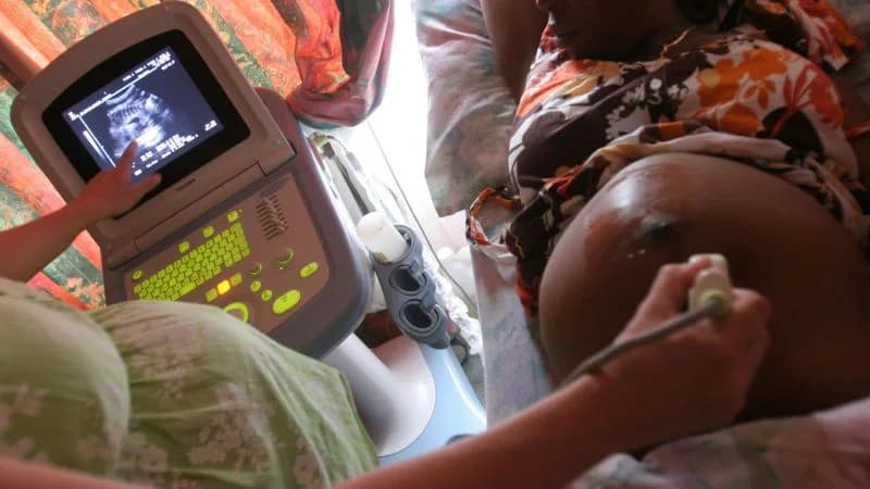 US Aid Cuts Disrupt Global HIV Services Despite Official Priorities