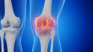 Stanford Study Finds Drug Can Regrow Knee Cartilage in Mice and Human Tissue
