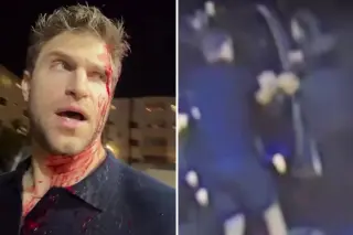 Actor Keegan Allen Hospitalized After Armed Robbery in West Hollywood