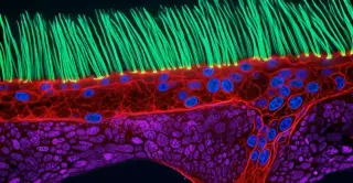 Nikon disqualifies AI-enhanced microscopy video, crowning new winner