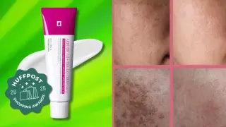 Korean Brightening Cream Slashes Melasma at 30% Off