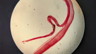 Philippine farmer’s brain infection confirmed via 1950s lab test showing egg tails