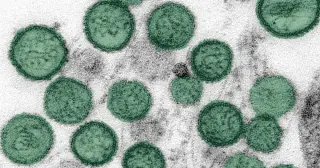 Colorado man contracts hantavirus from rodents, not cruise-ship outbreak