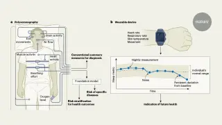 AI Models Reveal Sleep Data as a Predictor of Long-Term Disease Risk