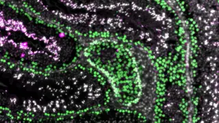 Meiosis-Targeted Breakthrough Moves Toward Reversible Nonhormonal Male Contraception