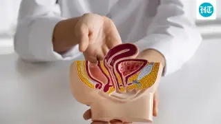 Colon cancer rising in younger adults prompts earlier screening and lifestyle focus