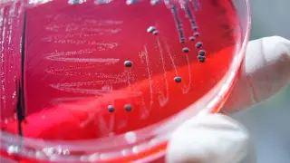 WHO: Global Death Toll From Foodborne Illness Surges