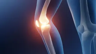 Aerobic Exercise Emerges as Top Pain Reliever for Knee Osteoarthritis