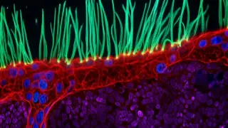 Nikon Disqualifies Microscopy Winner Over AI Use, Promotes Vietnamese Researcher