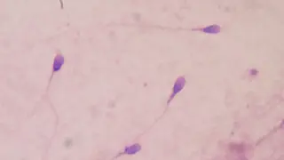 Utah Biotech Claims Lab-Grown Sperm Can Create Embryos, Fueling Fertility Breakthrough Debate