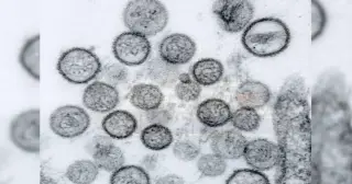 Hantavirus vs COVID-19: Distinct Origins and Public Health Realities