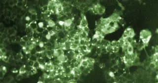 Pennsylvania records fifth measles death as outbreak reaches 943 cases