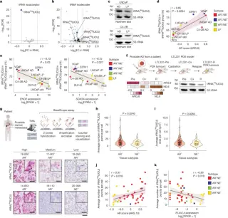 tRNA Dosage Shifts Prostate Cancer Lineage and Therapy Resistance