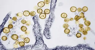 Colorado hantavirus death prompts public health review
