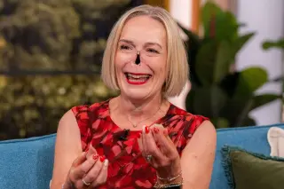 A Fleet of Magnetic Prosthetic Noses Helps One Woman Live Fully After Nose Collapse