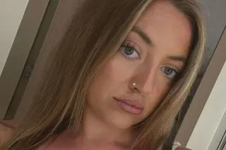 Ulcers Turned Tongue Cancer: 25-Year-Old Faces Partial Tongue Removal