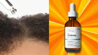 Peptide-Powered Serum Could Help Thicken Thinning Hair