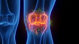 Outpatient GAE May Delay Knee Replacement