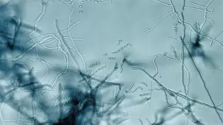 Soil-born antibiotic hits a novel ribosome site to tackle resistant bacteria