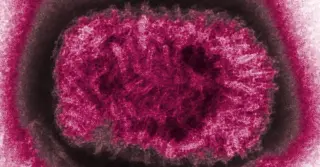 Ancient Smallpox Genomes Hint at Less Deadly Strains in 16th-Century Chile