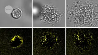 Exploding planarian cells reveal a new rapid death pathway