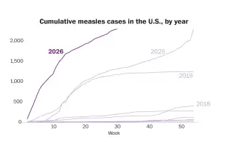 Measles Outbreak Surges to 35-Year High, CDC Warns