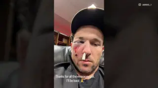 Bregman Hit in Face by Foul Ball; Cubs Head to Hospital for Tests
