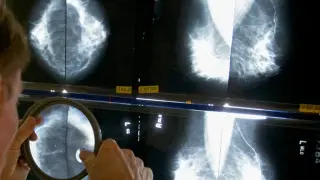 Mass. High School to Undergo Environmental Testing After Breast Cancer Diagnoses Among Female Teachers