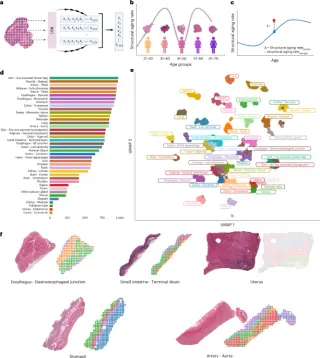 PathStAR maps organ-specific aging timelines and coordinated tissue decline