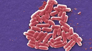 San Luis Obispo E. coli outbreak linked to Brookshire Farms leaves three children in ICU