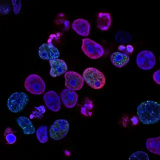 Three generations inside one cell: Scotland’s Caledochytrium aldermaii redefines microbial reproduction