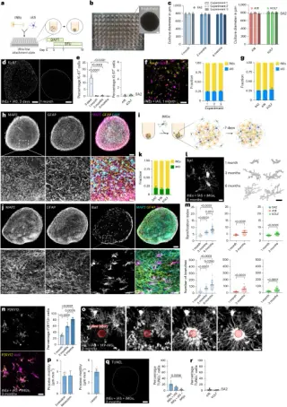 Reproducible 3D human brain tissue model reveals mature microglia and Alzheimer's disease hallmarks