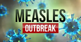 Kent County Measles Outbreak Expands to 20 Cases, Six Under 10