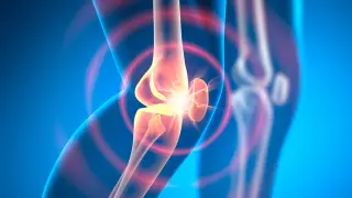 Injectable slow-release therapy reverses osteoarthritis in animal tests
