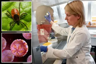 Powassan Virus Surges to Record U.S. Cases, Spreading Fast After Tick Bites