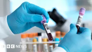 England Nears Hepatitis C Elimination Milestone Ahead of 2030 Goal