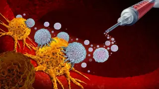 Intismeran phase 3 win accelerates personalized cancer vaccine momentum