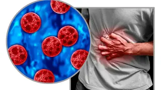 Ohio Cyclospora Outbreak Expands as Local Counts Diversify in Cincinnati