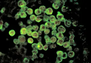 North Carolina teen dies from rare brain-eating amoeba linked to warm freshwater