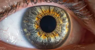 The Crescent That Stays: How a 2017 Eclipse Marked One Woman’s Retina