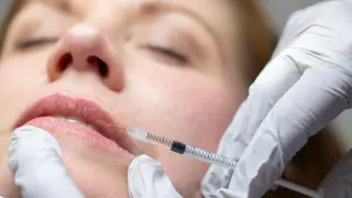 Zombie filler: cadaver fat fuels a rising cosmetic trend linked to Ozempic use