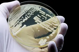 CDC Report: Drug-Resistant Germs Cause 50,800 US Deaths Annually